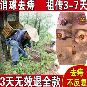 痔疮膏痔根断消肉球女性肛门治根止痒去痣疮男断痔华佗痔苍膏正品