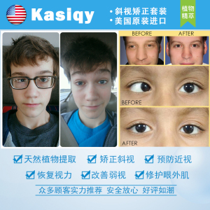纠正斜眼对眼斗鸡眼睛矫正器治斜视弱视治斜视儿童训练眼镜纠正器