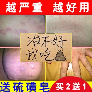 包邮】谢大夫苗疆五毒乳膏疥疮湿痒止痒膏疥舒藓痒硫磺软膏39人付款