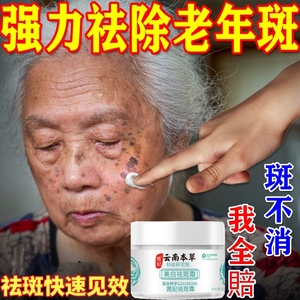 去老人斑专用药膏除老年黑班点斑霜黄褐斑强力祛除手部脸部的药膏