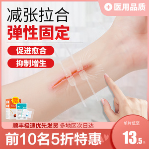 减张贴伤口缝合器免缝合创口贴创可贴皮肤免缝针疤痕儿童面部张力