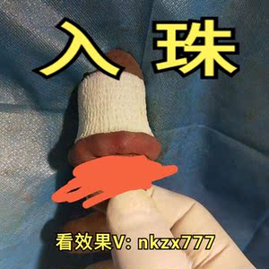男士阴茎入珠锁精环镶珠埋珠入龙珠龟头鸡鸡玻尿酸注射增粗增大套