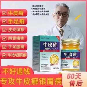 日本进口牛皮癣银屑湿疹皮肤病外用癣特效药膏止痒去根手足股藓