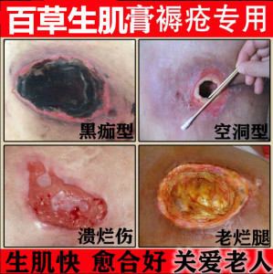 你我的原生态淘宝长皮生肌散促进长肉伤口结痂快速愈合 消 炎 粉