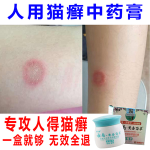 猫癣膏人