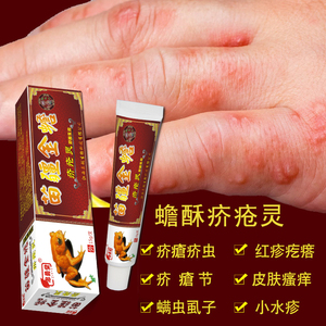 疥疮灵软膏
