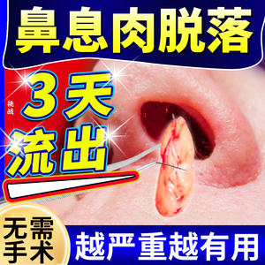 鼻息肉脱落专用药鼻窦炎根治疗修复鼻甲肥大鼻塞通鼻喷剂神器hh