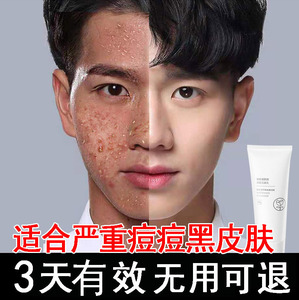 洗面奶男士专用控油祛痘印美白除螨虫去黑头粉刺收缩毛孔护肤洁面