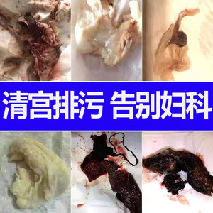清宫丸正品排毒紧致