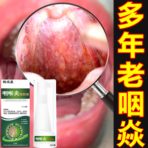 治疗咽喉炎慢性咽炎茶喷剂异物感喷雾根治滤泡增生神器药除根贴