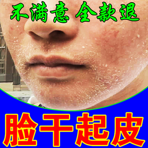 冬季保湿霜护肤品美白保湿补水脸部皮肤脸上干燥起皮叶子304901229