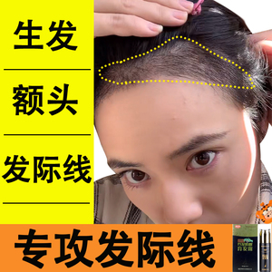 发际线增长液毛发生发液m型头发额头防脱头发增长液发际线生长液
