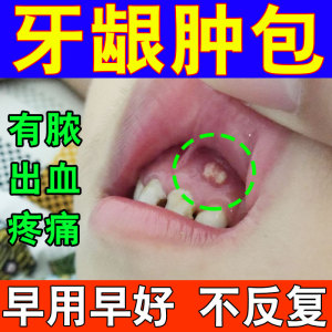 用口腔进口派丽奥派力奥牙周抑菌凝胶牙周宁软膏塞治剂朗力0人付款18