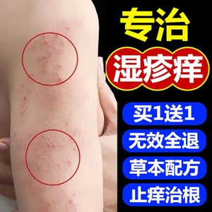 湿疹止痒去根脸部过敏红疹修复药皮肤干燥瘙痒湿痒抑菌外用百草膏