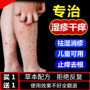 冬季小腿皮肤干燥痒湿疹湿痒全身过敏瘙痒外用抑菌百草止痒膏去根