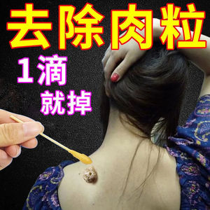 去肉刺神器