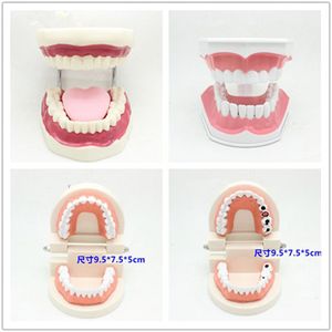2017新款牙齿模型放大可拆卸病理幼儿园教具蛀牙模具医用1:1现货