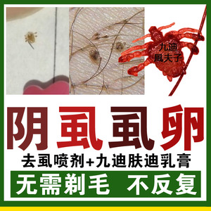 阴虱子药女去除虱虫无虱喷剂百部酊灭狮子跳蚤阴毛有虱子精立净尽