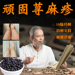 慢性急性荨麻疹过敏止痒去根源专用内服丸中药克星人工胆碱能丘疹