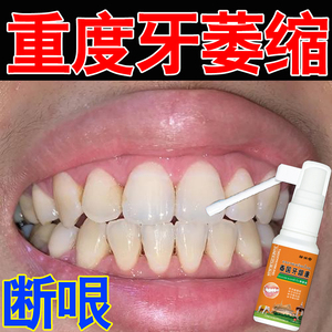牙龈i萎缩修复再生专用牙膏牙周焱牙根外露牙齿松动药牙疼牙缝宽