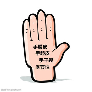 手脱皮修复霜季节性手掌手指头蜕皮开裂干裂手气爽褪起皮掉皮爆皮