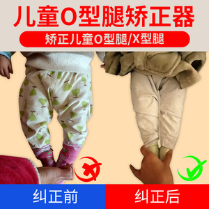 儿童o型腿矫正器幼儿