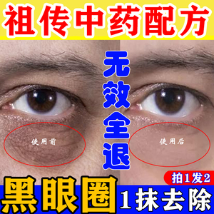 中淡化黑眼圈去除神器男士专用女士眼霜贴改善特别严重黑眼圈祛药