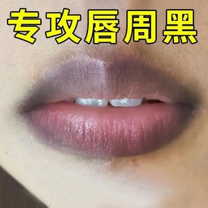 去除唇周黑色素嘴角发黑暗沉唇部去黑改善嘴角边缘黑嘴唇发紫乌黑