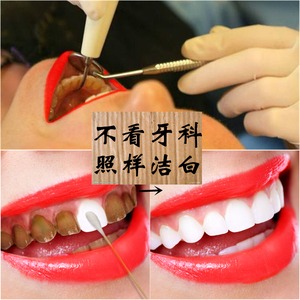 牙齿美白速效去黄牙烟牙斑净牙垢黑渍洗牙粉液牙贴牙膏神器白牙素