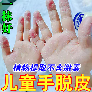 小孩手指头蜕皮手脱皮严重专用药膏儿童手脚上起皮干燥掉皮护手霜