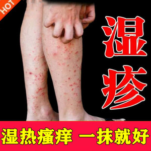 湿疹止痒去根顽固皮炎外用全身慢性过敏红疹抑菌皮肤瘙痒止痒药膏