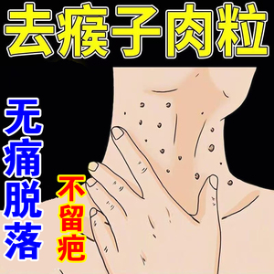面部扁平疣去除脖子小肉粒颈部不留疤祛丝状尤腋下小猴子克疣液sx