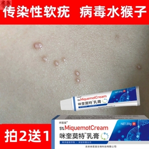 去传染性软疣儿童病毒性软疣膏水瘊子药膏去除扁平疣治疗水猴子药