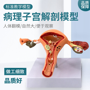 人体模型女性生殖子宫模型阴道卵巢模型教学模具病理变化科学教具