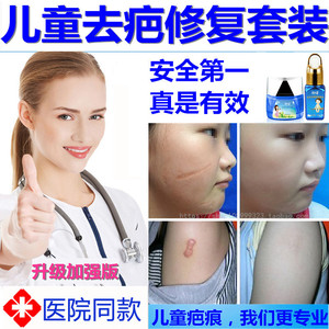 儿童祛疤正品去疤痕凹凸疤修复膏手术增生疤痕灵烫伤疤除疤痘印霜
