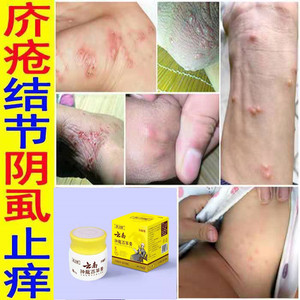 治疗疥疮膏螨虫阴虱结节一扫光硫磺软膏阴囊瘙痒皮肤止痒外用药