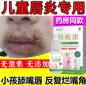 儿童唇炎专用口周皮炎药膏口角炎唇膏软膏烂嘴角嘴唇疱疹开裂ss