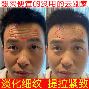 【去皱纹抬头纹男神器】去皱纹抬头纹男神器品牌,价格 - 阿里巴巴