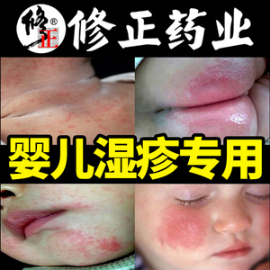 湿疹婴儿专用婴幼儿口水疹热疹奶藓膏干性皮肤保湿止痒抑菌宝宝霜