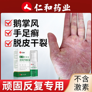 00阿里健康大药房天猫手癣脚癣花斑体癣手足癣药膏手气干裂脱皮真菌