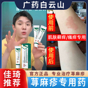 荨麻疹过敏止痒断专用药膏 药皮肤瘙痒抑菌的药止痒膏红痒肌肤根