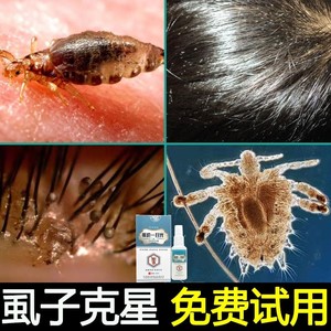 猪友皇智清虱五号净虱克星浣沙清虱王滋兹妥通济克虱露堂头虱阴虱