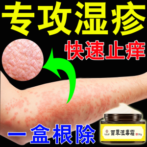 湿疹止痒去根药膏皮肤瘙痒止痒抑菌全身痒外用药皮炎皮疹过敏红疹