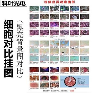 黑背景一滴血检测仪细胞挂图干血对比挂图血液对比图例分析