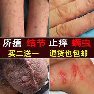 807人付款淘宝特效疥疮结节一扫光治皮炎湿疹干苍根除阴囊虱虫止瘙痒