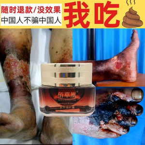 老烂腿专用药静脉曲张老烂腿脉管炎老烂腿生机膏老烂腿伤口愈合