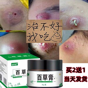 皮脂腺囊肿膏去除皮下囊肿粉瘤脓包痤疮拔脓膏火疖子拔毒神器药膏
