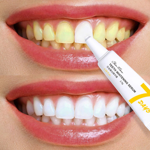 牙齿美白凝胶速效去黄洁白神器美牙笔剂黄牙烟牙男女牙垢清新口气