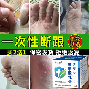 浓复方苯甲酸去角质足癣脚气去角质软膏老皮烂脚丫脚脱皮脚痒药膏