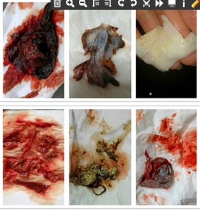 泡腾片女性私处